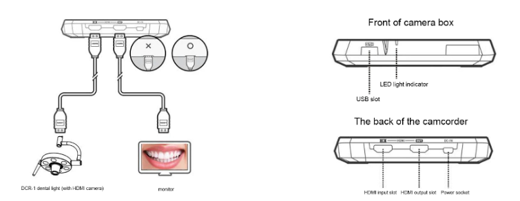 implant chair